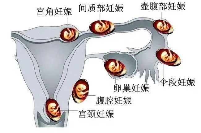 泰国试管对比国内竟有4大优势，赴泰助孕夫妻赶快看过来