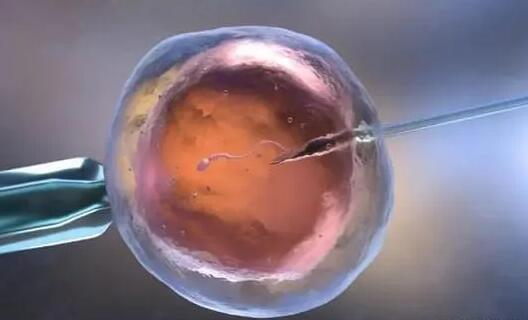 美国试管婴儿助孕三大优势揭秘，筛选胚胎性别只是其一